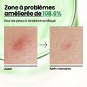 Anua Azelaic Acid 10 Hyaluron Redness Soothing Serum