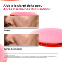 Anua TXA4 Niacinamide 10 avant après - unyskin