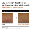 Toner Anua 70 rice milky avant après - Unyskin