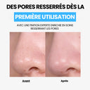Ilso Natural Mild Clear Nose Pack